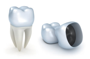tipi-di-protesi-dentali-2